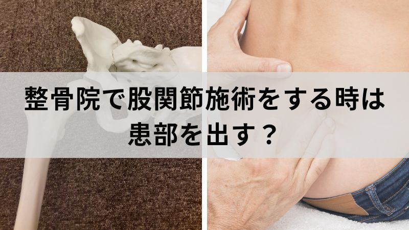 整骨院　股関節の施術　患部を出す