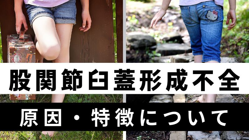 股関節臼蓋形成不全｜座り方・やってはいけないことを解説