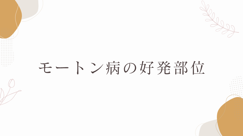 モートン病の好発部位